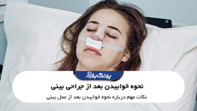نحوه خوابیدن بعد از جراحی بینی