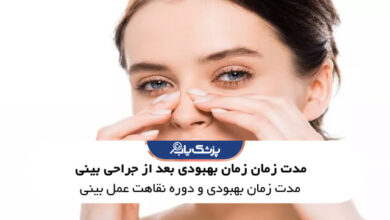 مدت زمان بهبودی بعد از جراحی بینی