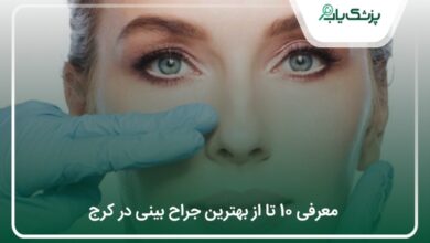 بهترین جراح بینی در کرج