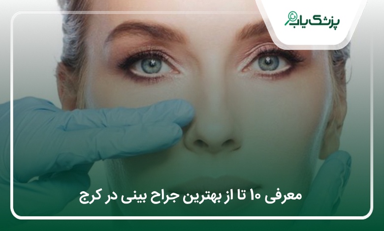 بهترین جراح بینی در کرج