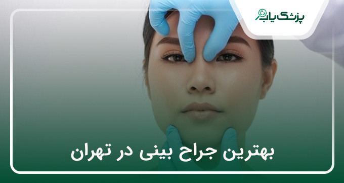 بهترین جراح بینی در تهران