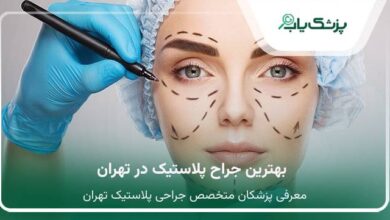 بهترین جراح پلاستیک در تهران