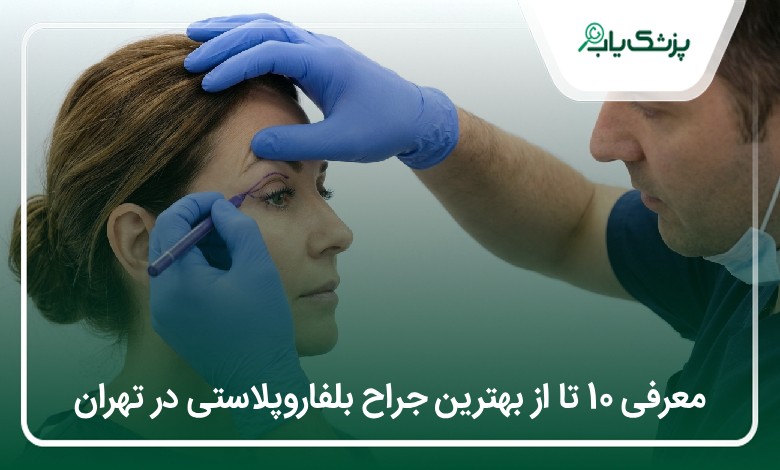 بهترین جراح بلفاروپلاستی در تهران
