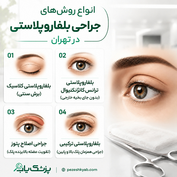 انواع روشهای جراحی بلفاروپلاستی در تهران