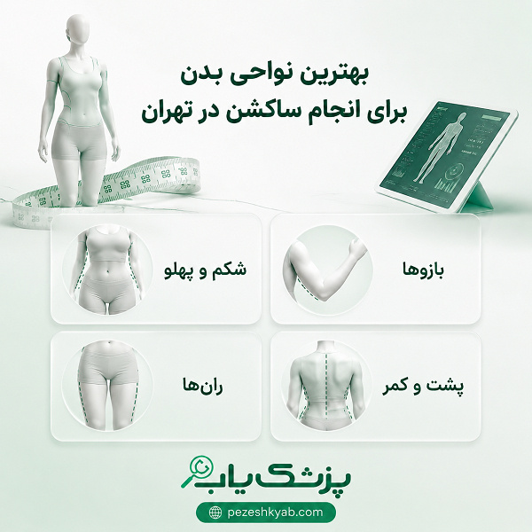 بهترین نواحی بدن برای انجام ساکشن در تهران