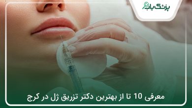 بهترین دکتر تزریق ژل در کرج
