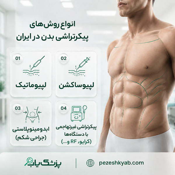 انواع روشهای پیکرتراشی بدن در ایران