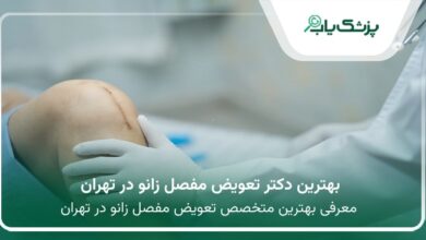 بهترین دکتر تعویض مفصل زانو در تهران