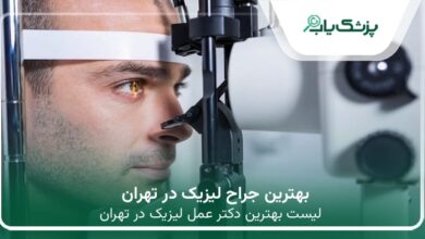 بهترین جراح لیزیک در تهران