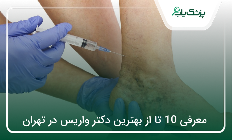 بهترین دکتر واریس در تهران