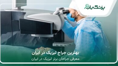 بهترین جراح لیزیک در ایران