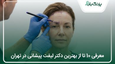 بهترین دکتر لیفت پیشانی در تهران