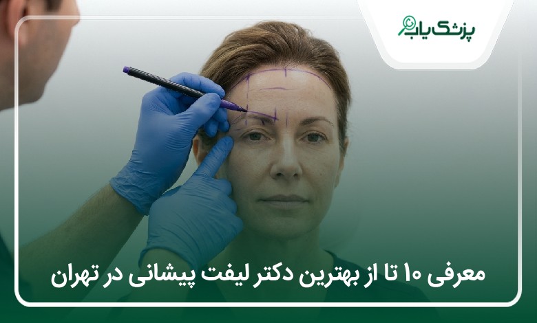 بهترین دکتر لیفت پیشانی در تهران