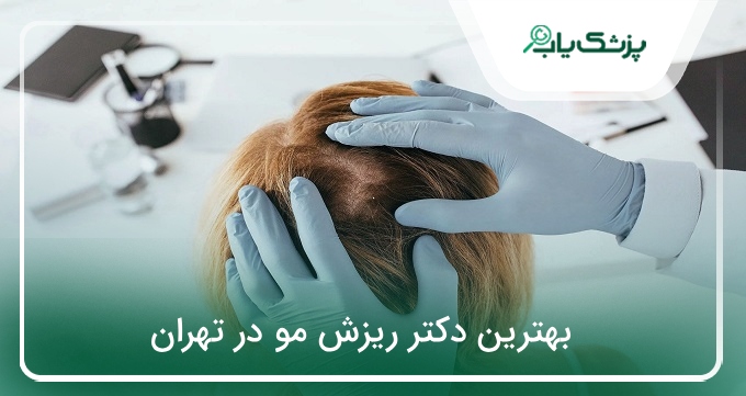 بهترین دکتر ریزش مو در تهران