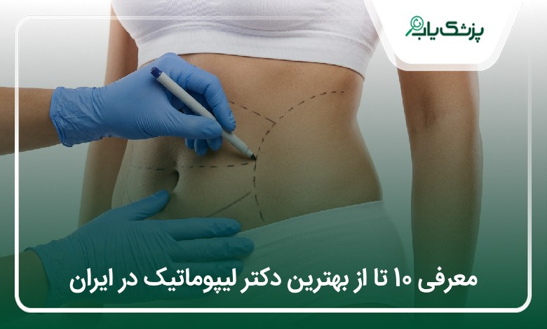 بهترین دکتر لیپوماتیک در ایران