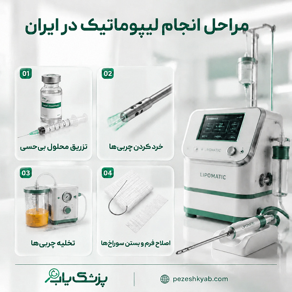 مراحل انجام عمل لیپوماتیک در ایران