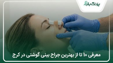 بهترین جراح بینی گوشتی در کرج