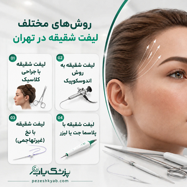 روشهای مختلف لیفت شقیقه در تهران