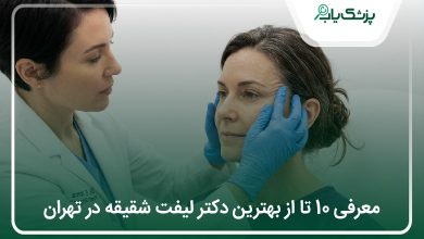 بهترین دکتر لیفت شقیقه در تهران