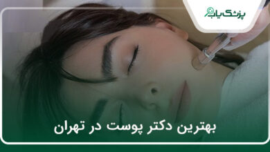 بهترین دکتر پوست در تهران