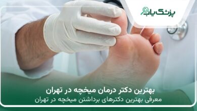 بهترین دکتر درمان میخچه در تهران