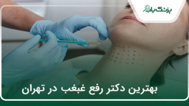 بهترین دکتر رفع غبغب در تهران