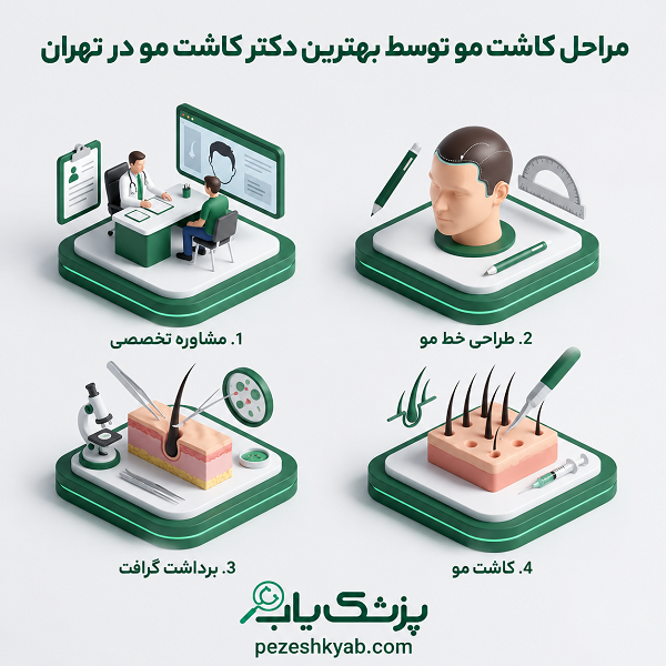 مراحل کاشت مو توسط بهترین دکتر کاشت مو در تهران