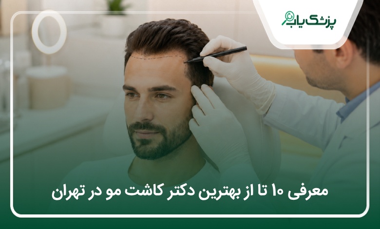 بهترین دکتر کاشت مو در تهران