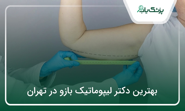بهترین دکتر لیپوماتیک بازو در تهران
