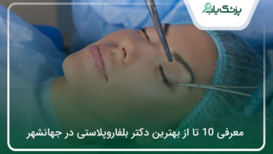 بهترین دکتر بلفاروپلاستی در جهانشهر