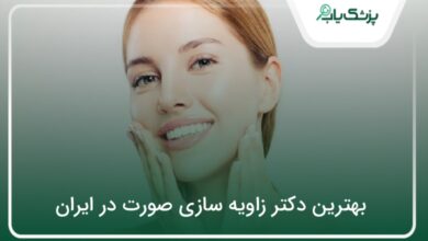 بهترین دکتر زاویه سازی صورت در ایران