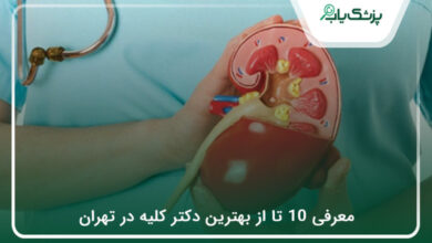 بهترین دکتر کلیه در تهران
