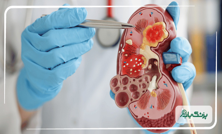 اقدامات دکتر متخصص کلیه برای درمان بیماران