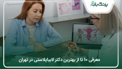 بهترین دکتر لابیاپلاستی در تهران