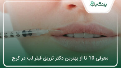 بهترین دکتر تزریق فیلر لب در کرج