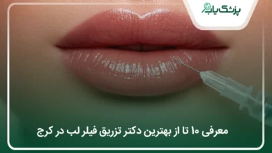 بهترین دکتر تزریق فیلر لب در کرج