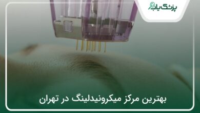 بهترین مرکز میکرونیدلینگ در تهران