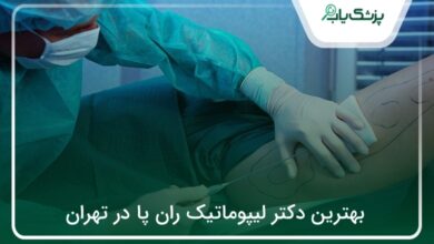 بهترین دکتر لیپوماتیک ران پا در تهران