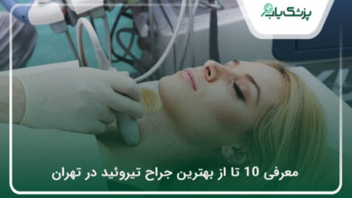 بهترین جراح تیروئید در تهران