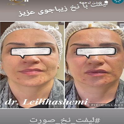 دکتر لیلی هاشمی