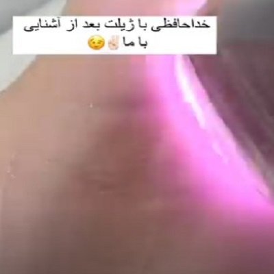 نمونه کار مرکز تخصصی لیزر پردیس