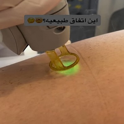 نمونه کار کلینیک بهین لیزر