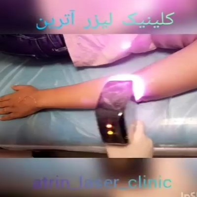 نمونه کار کلینیک لیزر آقایان آترین