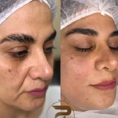 کلینیک زیبایی گلدن