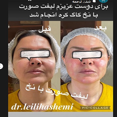 دکتر لیلی هاشمی