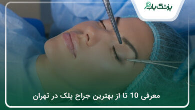 بهترین جراح پلک در تهران