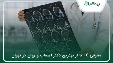 بهترین دکتر اعصاب و روان در تهران