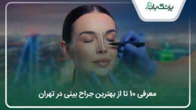 بهترین جراح بینی در تهران
