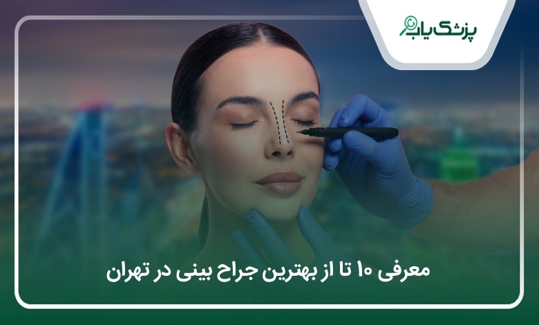 بهترین جراح بینی در تهران