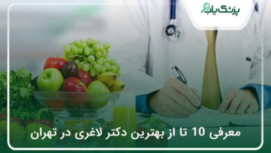 بهترین دکتر لاغری در تهران
